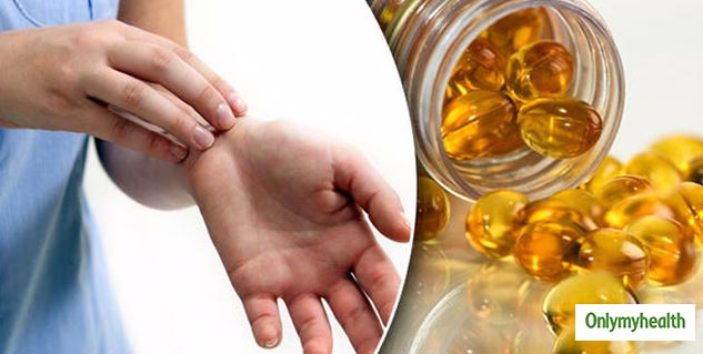 Fish Oil Supplement For Seborrheic Eczema  
