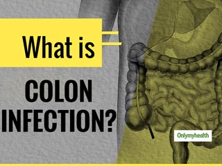 What Are The Signs And Symptoms Of Colon Cancer?