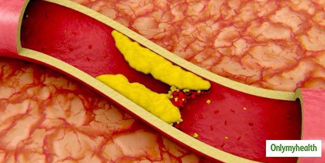 cholesterollow