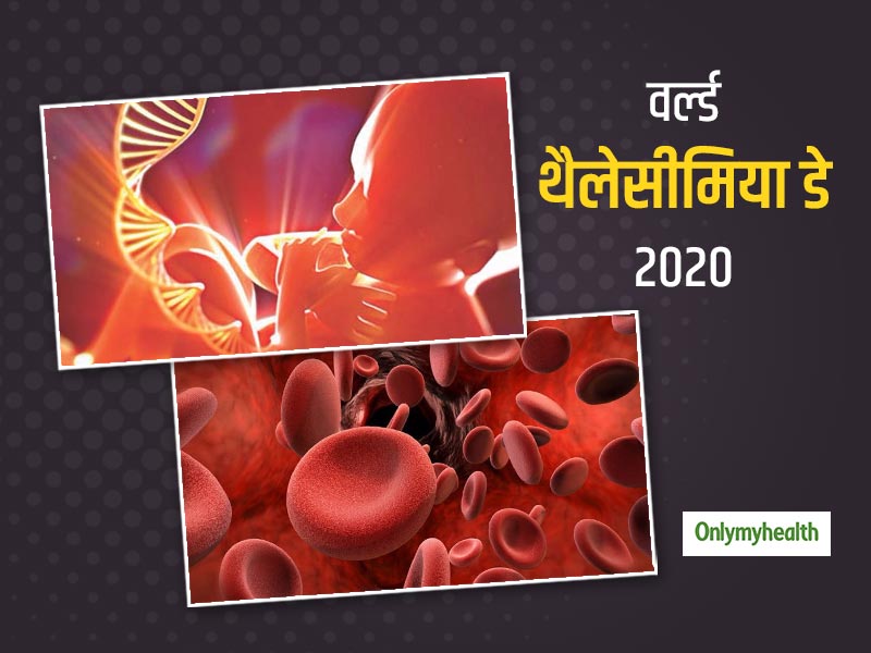 World Thalassaemia Day 2020: जेनेटिक रोग है थैलेसीमिया, जानें इस बीमारी के कारण, लक्षण और उपचार के तरीके
