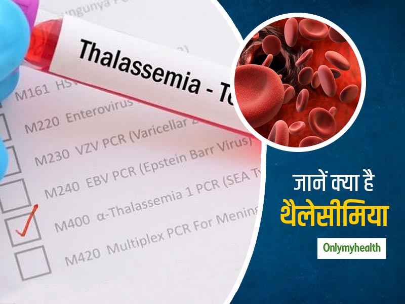World Thalassemia Day 2020: सामान्य से कम हीमोग्लोबिन का कारण हो सकता है थैलेसीमिया, जानें इसके लक्षण और बचाव