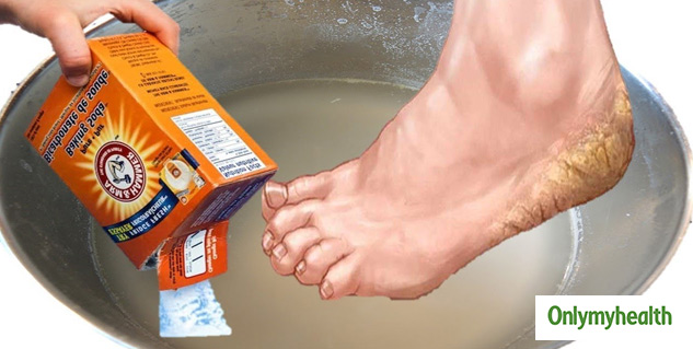 Baking Soda For Foot Corns