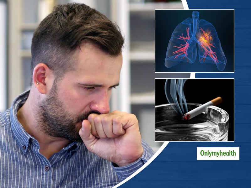 Nonsmokers With Lung Cancer Cases Increased By 35%: Dr Pankaj Kumar Pandey