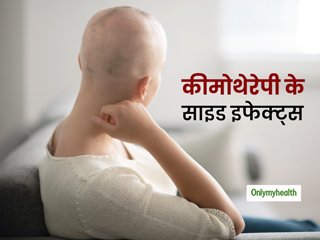 ज्यादा थकावट और बाल झड़ना है कीमोथेरेपी के साइ़ड इफेक्ट्स, इस तरह करें इससे अपना बचाव