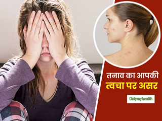 आपके चेहरे की रंगत बताती है आपके स्ट्रेस का लेवल, जानें कैसे तनाव का आपकी त्वचा पर होता है गहरा असर