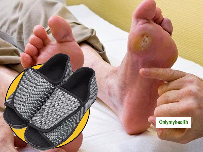 Best Shoes for Foot Ulcers: Comfortable and Supportive Options