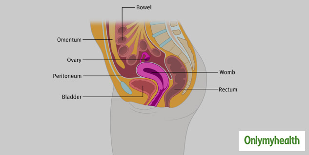 Peritoneal Cancer Treatment 
