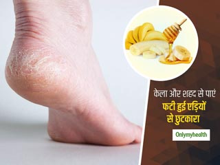 फटी एड़ियों से छुटकारा दिलाएगा केले और शहद से बना ये फुट मास्क, सुंदर और मुलायम हो जाएंगे पैर