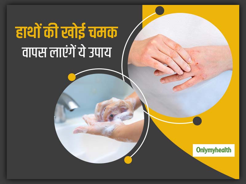 Remedies For Dry Hands: बार-बार साबुन से हाथ धोने से खो गई है हाथों की चमक, तो आज ही अपनाएं ये 7 उपाय 