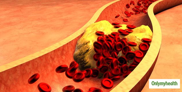cholesterol