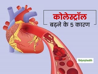 सिर्फ गलत फूड्स ही नहीं, इन 5 कारणों से भी बढ़ता है बैड कोलेस्ट्रॉल, हार्ट की बीमारी से बचना है तो रहें सावधान