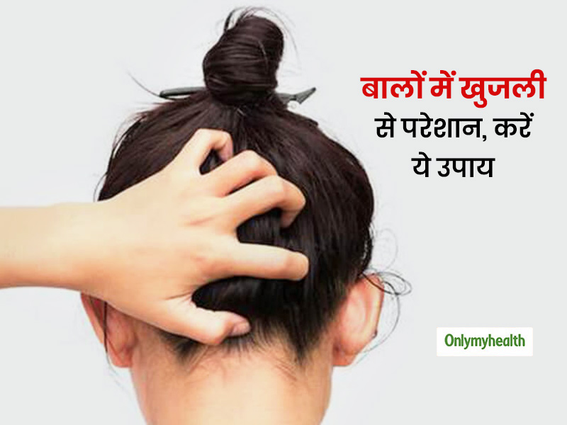 5 Home Remedies For An Itchy Scalp In Hindi | 5 उपायों से साफ करें सिर पर  जमी पपड़ी