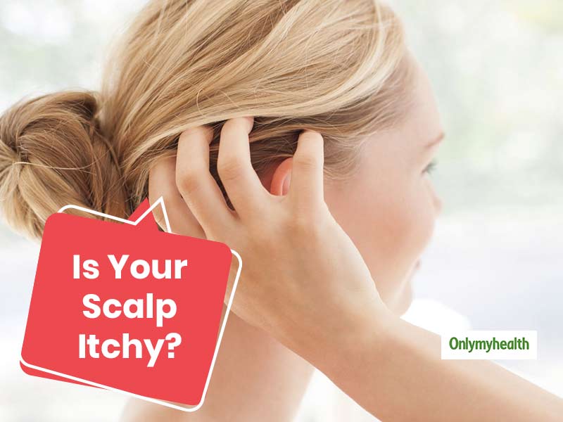 home remedies for itchy scalp in summer