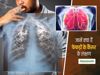 World Lung Cancer Day 2020: इन तरीकों से करें फेफड़ों के कैंसर की पहचान, जानें कैसे आपको करना चाहिए बचाव