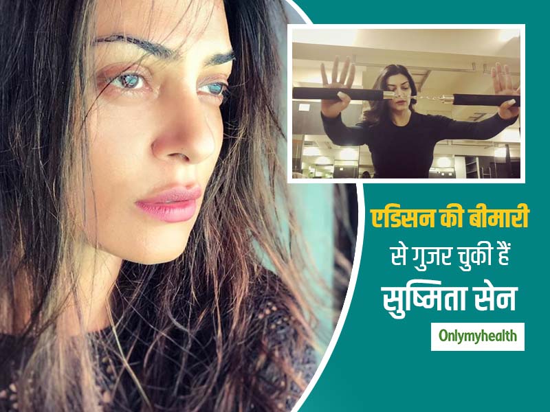 बॉलीवुड एक्ट्रेस सुष्मिता सेन को हुआ था ऑटो-इम्यून डिजीज एडिसन, इस जापानी मार्शल आर्ट से बनाया था खुद को मजबूत