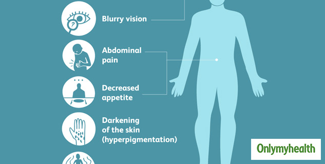 Addison's Disease Symptoms