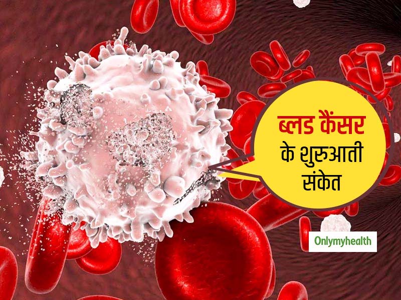 ल्यूकेमिया और ये 2 टाइप के ब्लड कैंसर के शुरुआती संकेत होते हैं बेहद ही साधारण, जरा सी भूल ले सकती है आपकी जान