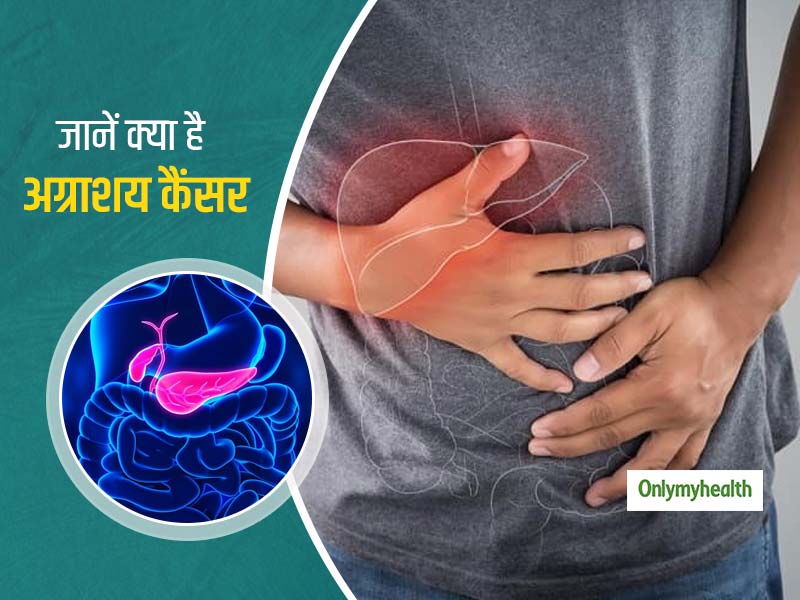 causes of pancreatic cancer in hindi - अग्नाशय कैंसर क्यों होता है