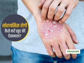 तनाव के चलते बढ़ सकता है सोरायसिस का दर्द, डॉ. मोनिका बांबरू से जानिए लॉकडाउन में कैसे करें बचाव 