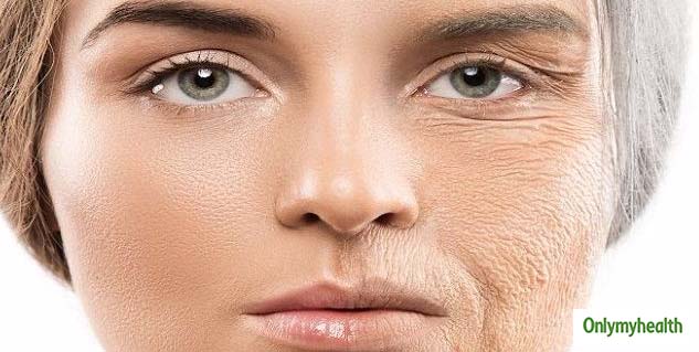 aging