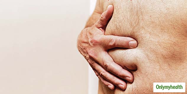 HERNIA