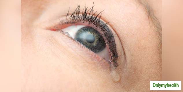 5-most-common-causes-of-watery-eyes-and-home-remmedies-for-watery-eyes