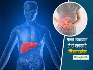 लिवर एब्सेस रोग से बचने के लिए अपनी डाइट में लाएं सुधार, खानपान की इन गलत आदतों से होती है ये बीमारी