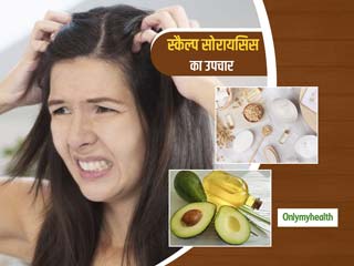 Hair Care: पसीने और उमस से भी बालों में होता है Scalp Psoriasis, छुटकारा पाने के लिए अपनाएं ये 5 घरेलू उपाय