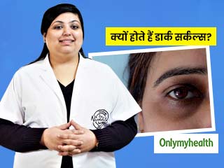 आंखों के नीचे काले घेरे (डार्क सर्कल्स) का कारण सिर्फ नींद की खराबी नहीं, डर्मेटोलॉजिस्ट से जानें अन्य कारण