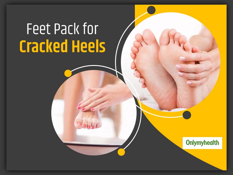 5 Easy Ways To Treat Cracked Heels – SkinKraft