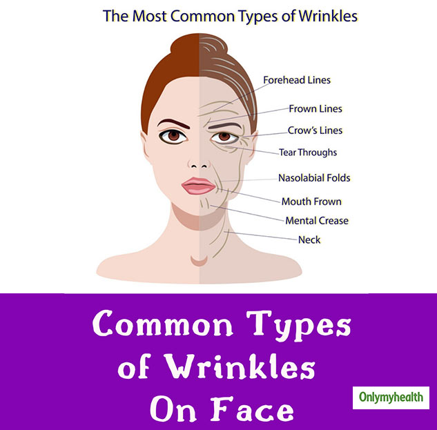 here-s-all-you-need-to-know-about-types-of-wrinkles-and-tips-to-reduce