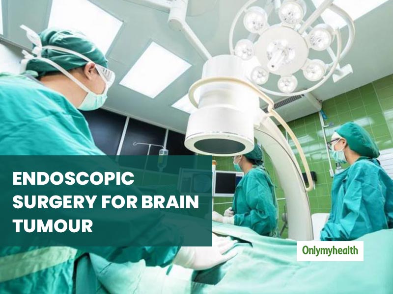 What Is Endoscopic Brain Surgery