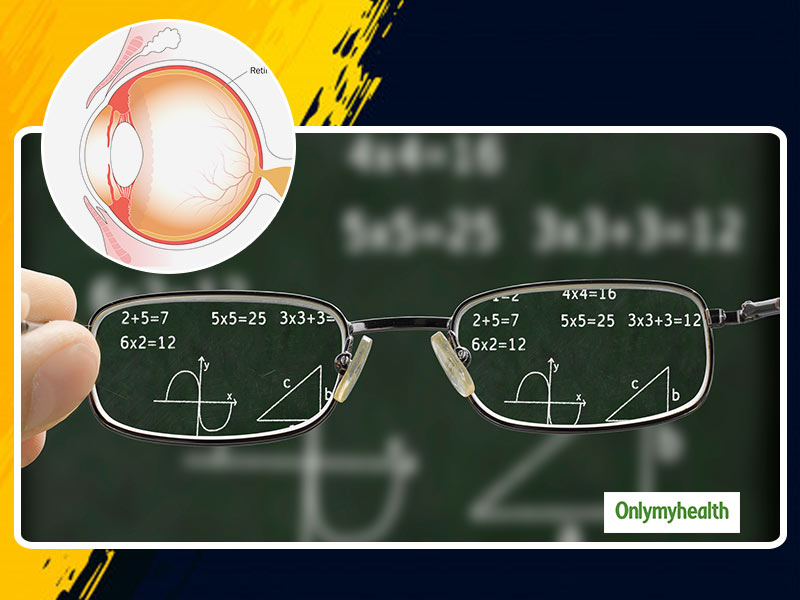Does Lifestyle-Induced Myopia Cause Vision Impairment? Explains Ophthalmologist Hemant Todkar