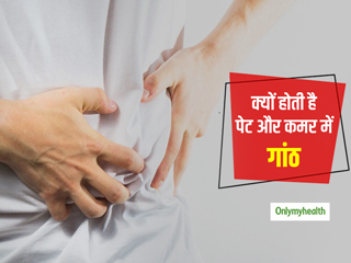 कमर, पेट और जांघ में गांठ जैसी समस्या को ना करें इग्नोर, हो सकती है ये गंभीर समस्या