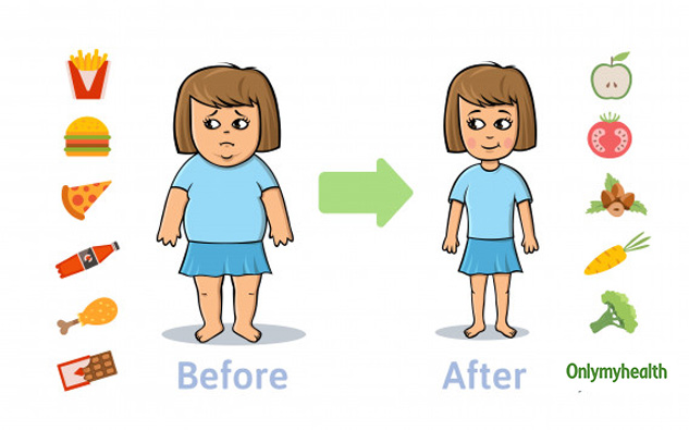  Obesity in kids, Childhood obesity