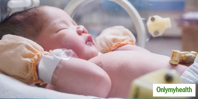 premature baby