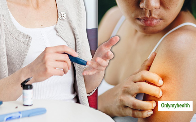 diabetes signs on skin