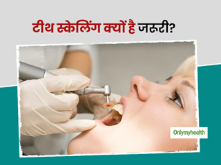 दांतों के लिए क्यों जरूरी है टीथ स्केलिंग? जानिए इसके फायदे