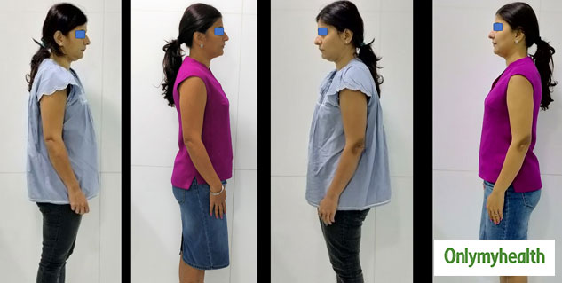 Is Your Bite And Posture Related? Explains Dentist Rinku Jain ...