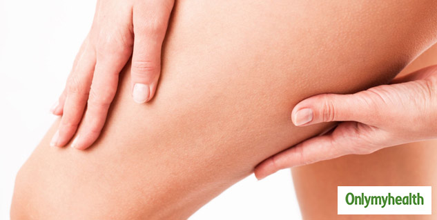 5 home remedies