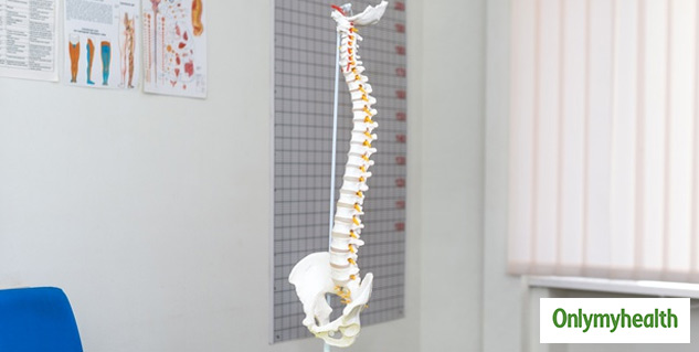 Cervical Spondylitis
