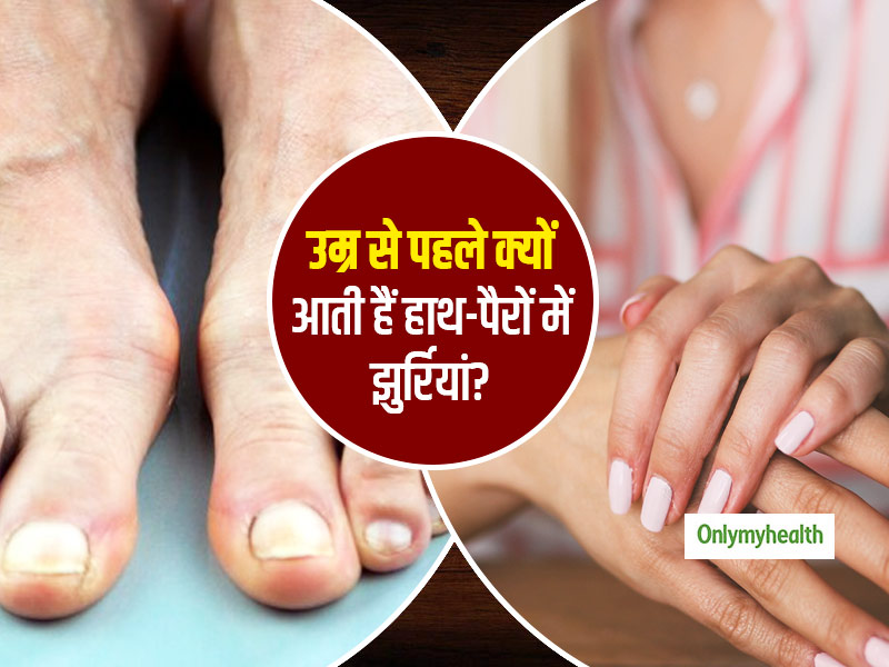 उम्र से पहले हाथ-पैरों में क्यों पड़ने लगती हैं झुर्रियां? जानें क्या है इससे बचाव का आसान तरीका