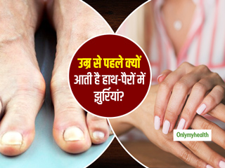 उम्र से पहले हाथ-पैरों में क्यों पड़ने लगती हैं झुर्रियां? जानें क्या है इससे बचाव का आसान तरीका