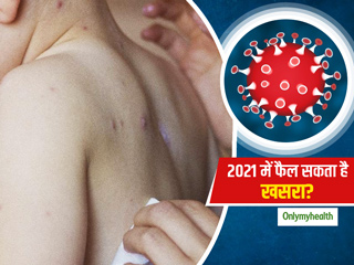 कोरोना महामारी के कारण साल 2021 में फैल सकता है खसरा (Measles), शोधकर्ताओं ने लोगों को किया सचेत 