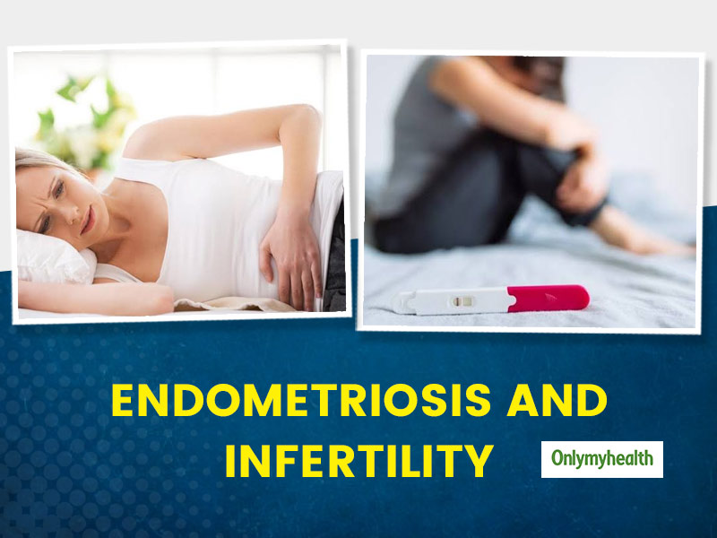 What Is The Connection Between Endometriosis And Infertility Know From Fertility Specialist Dr 9063