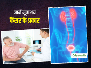 कितने प्रकार के होते हैं मूत्राशय कैंसर (Bladder Cancers) ? जानें किन लोगों को होता है इसका ज्यादा खतरा