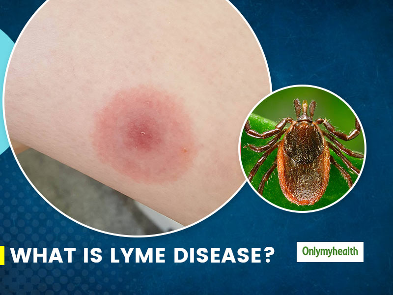 whats lyme disease