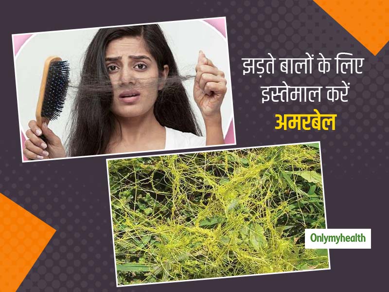 झड़ते बालों को रोकने और बालों में जान डालने के लिए मैंने ऐसे किया अमरबेल का इस्तेमाल, जानें 2 आसान नुस्खे