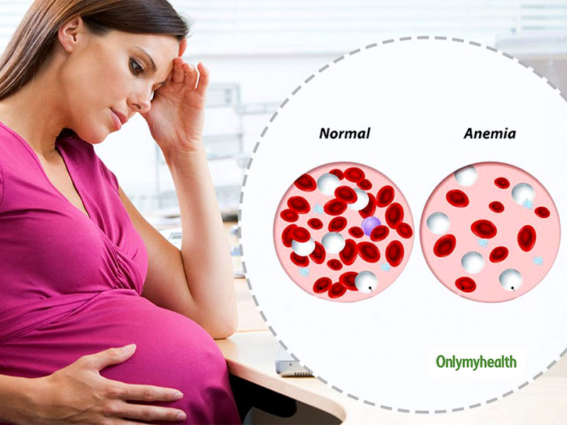 Anaemia During Pregnancy Know Symptoms Treatment And Preventive Measures By This Gynecologist 6361