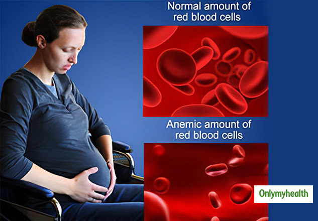 Anaemia During Pregnancy Know Symptoms Treatment And Preventive Measures By This Gynecologist 0943